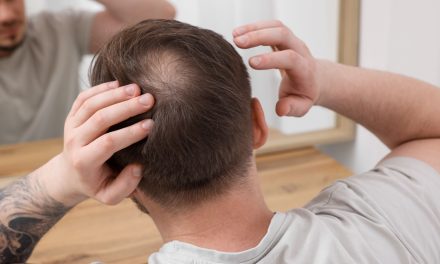 The Lowdown on Hair Loss: Why It Happens (and How to Fix It)