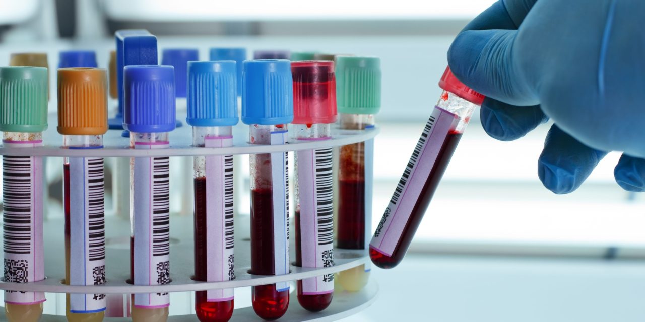 At-Home Blood Testing: Revolutionising Personal Health Management