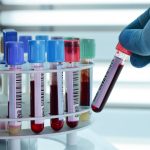 At-Home Blood Testing: Revolutionising Personal Health Management