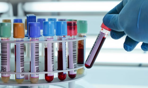 At-Home Blood Testing: Revolutionising Personal Health Management