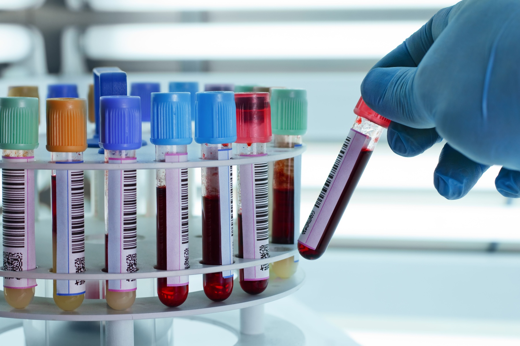 At-Home Blood Testing: Revolutionising Personal Health Management